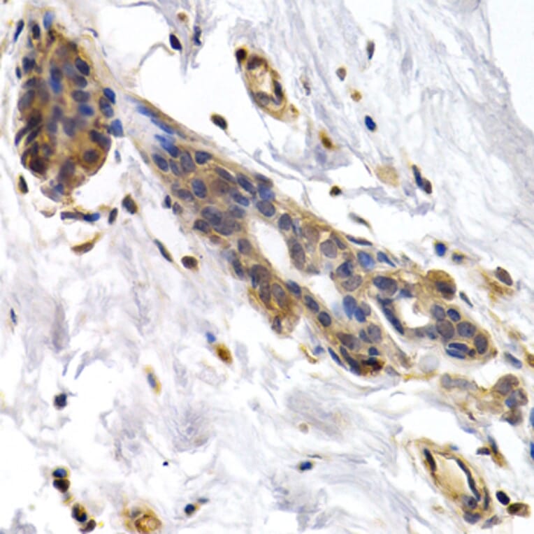 Immunohistochemistry - Anti-PKLR Antibody (A1924) - Antibodies.com