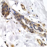 Immunohistochemistry - Anti-PKLR Antibody (A1924) - Antibodies.com