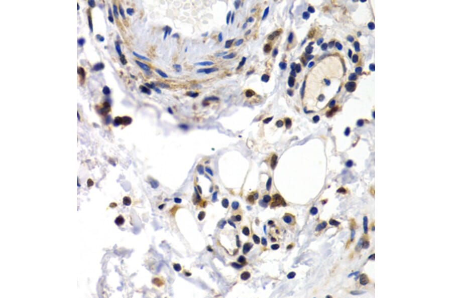 Immunohistochemistry - Anti-PKLR Antibody (A1924) - Antibodies.com