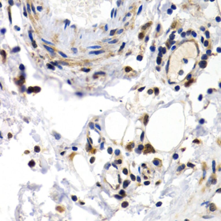 Immunohistochemistry - Anti-PKLR Antibody (A1924) - Antibodies.com