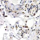 Immunohistochemistry - Anti-PKLR Antibody (A1924) - Antibodies.com