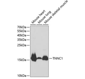 Western Blot - Anti-TNNC1 Antibody (A13748) - Antibodies.com