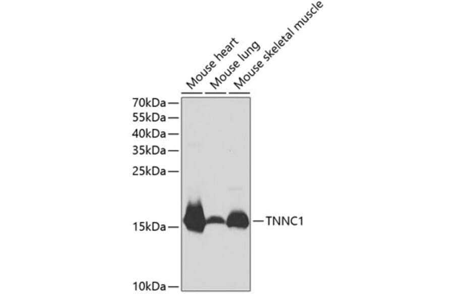 Western Blot - Anti-TNNC1 Antibody (A13748) - Antibodies.com
