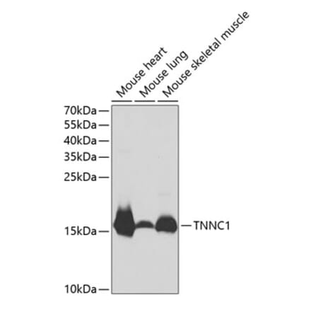 Western Blot - Anti-TNNC1 Antibody (A13748) - Antibodies.com