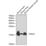 Western Blot - Anti-TNNC1 Antibody (A13748) - Antibodies.com