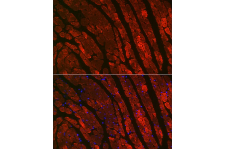 Immunofluorescence - Anti-TNNC1 Antibody (A13748) - Antibodies.com