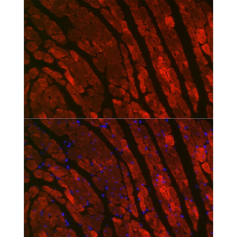 Immunofluorescence - Anti-TNNC1 Antibody (A13748) - Antibodies.com