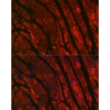 Immunofluorescence - Anti-TNNC1 Antibody (A13748) - Antibodies.com