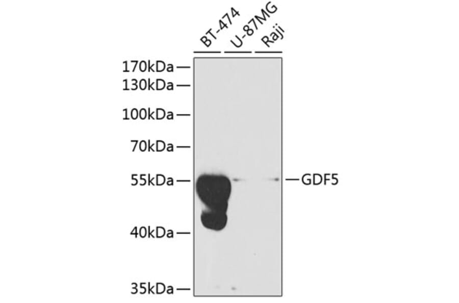 Western Blot - Anti-GDF 5 Antibody (A13749) - Antibodies.com