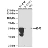 Western Blot - Anti-GDF 5 Antibody (A13749) - Antibodies.com