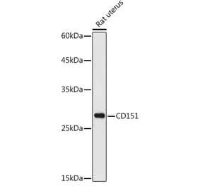 Western Blot - Anti-CD151 Antibody (A13750) - Antibodies.com