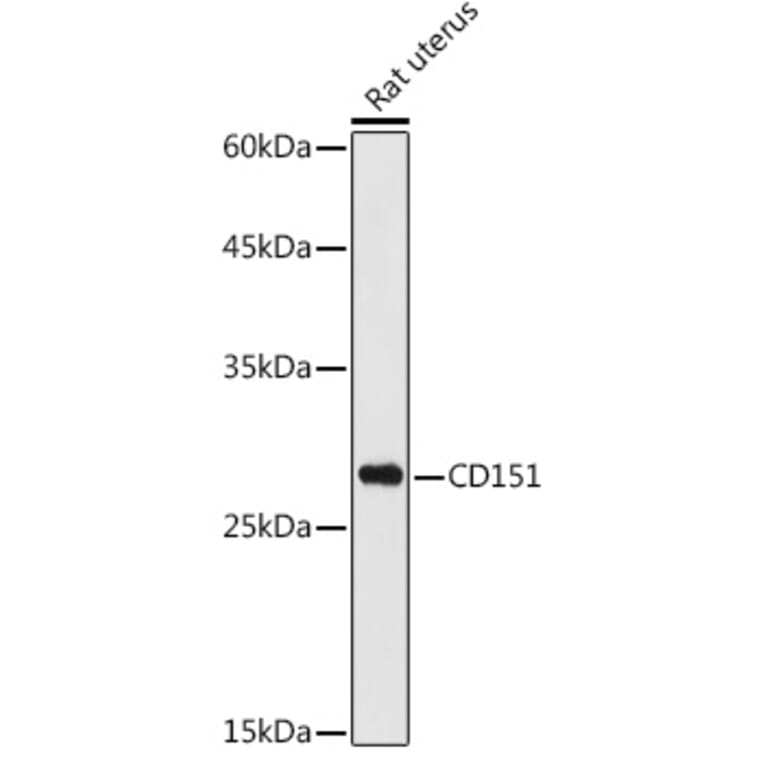Western Blot - Anti-CD151 Antibody (A13750) - Antibodies.com