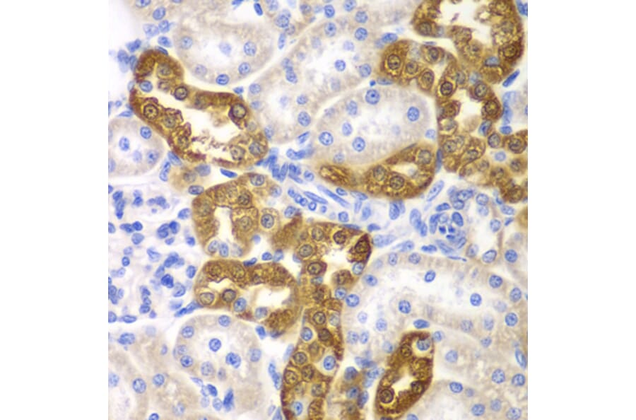 Immunohistochemistry - Anti-CD151 Antibody (A13750) - Antibodies.com
