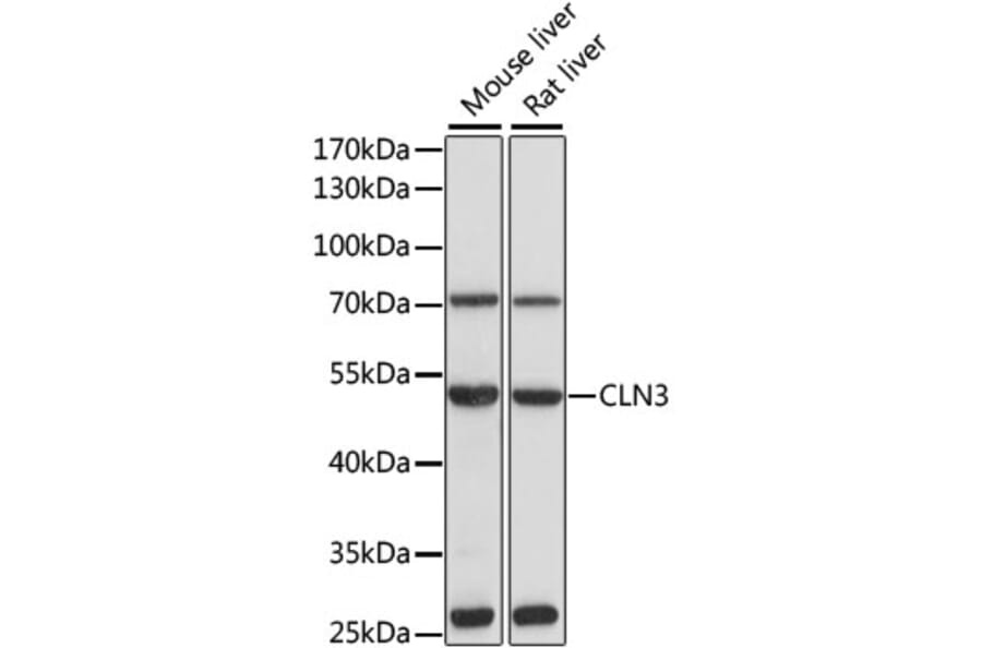 Western Blot - Anti-CLN3 Antibody (A13751) - Antibodies.com