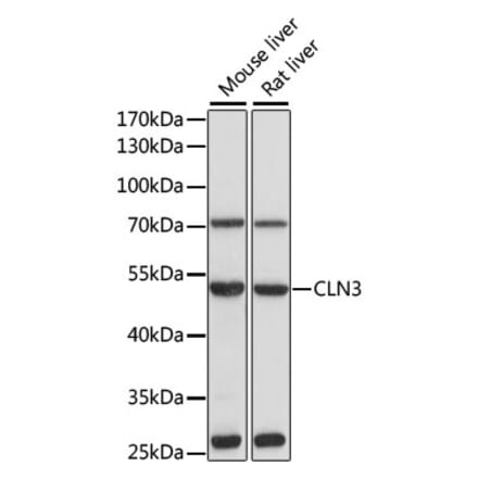 Western Blot - Anti-CLN3 Antibody (A13751) - Antibodies.com