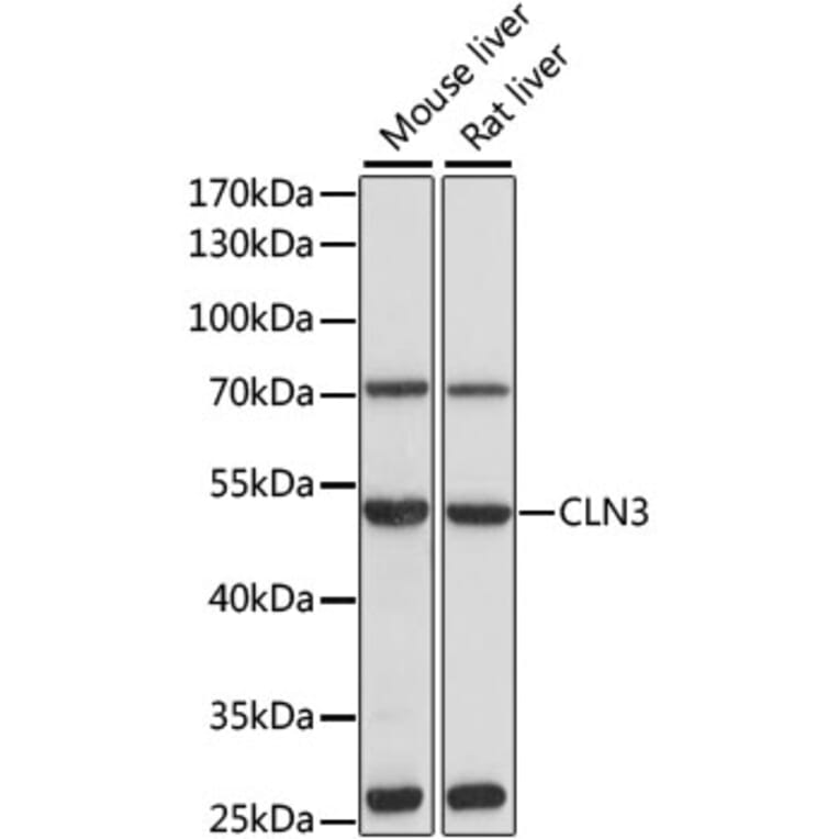 Western Blot - Anti-CLN3 Antibody (A13751) - Antibodies.com