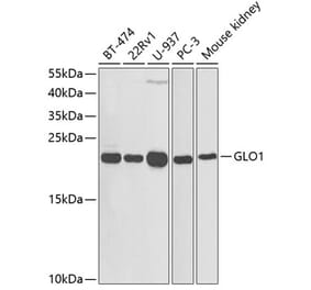 Western Blot - Anti-GLO1 Antibody (A13752) - Antibodies.com