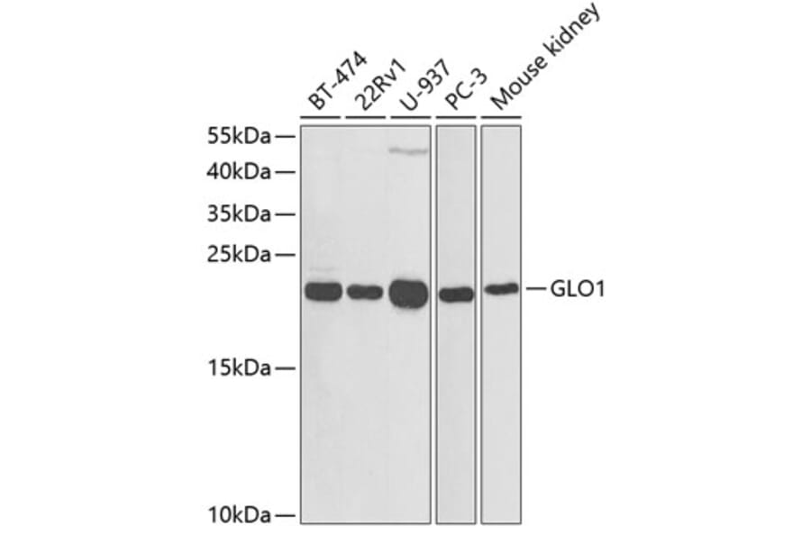 Western Blot - Anti-GLO1 Antibody (A13752) - Antibodies.com