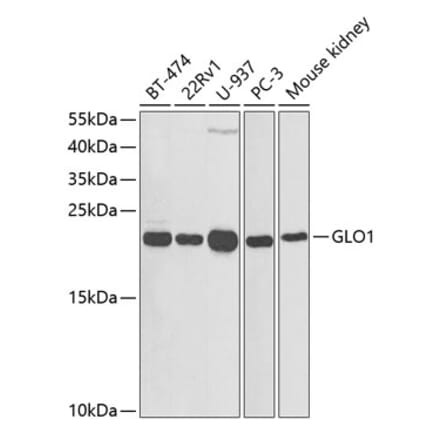 Western Blot - Anti-GLO1 Antibody (A13752) - Antibodies.com