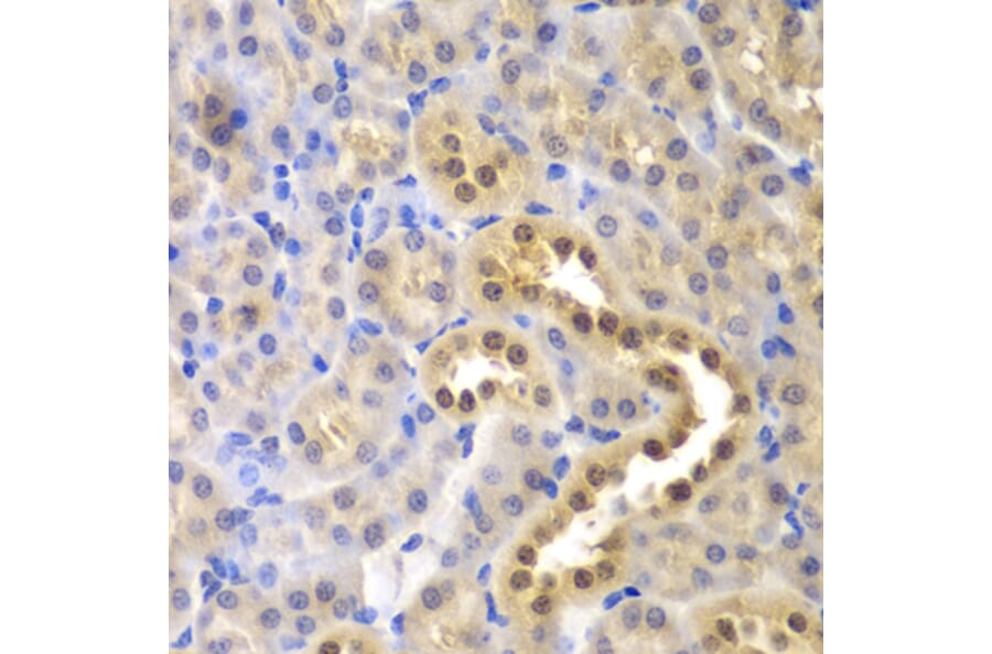 Immunohistochemistry - Anti-GLO1 Antibody (A13752) - Antibodies.com