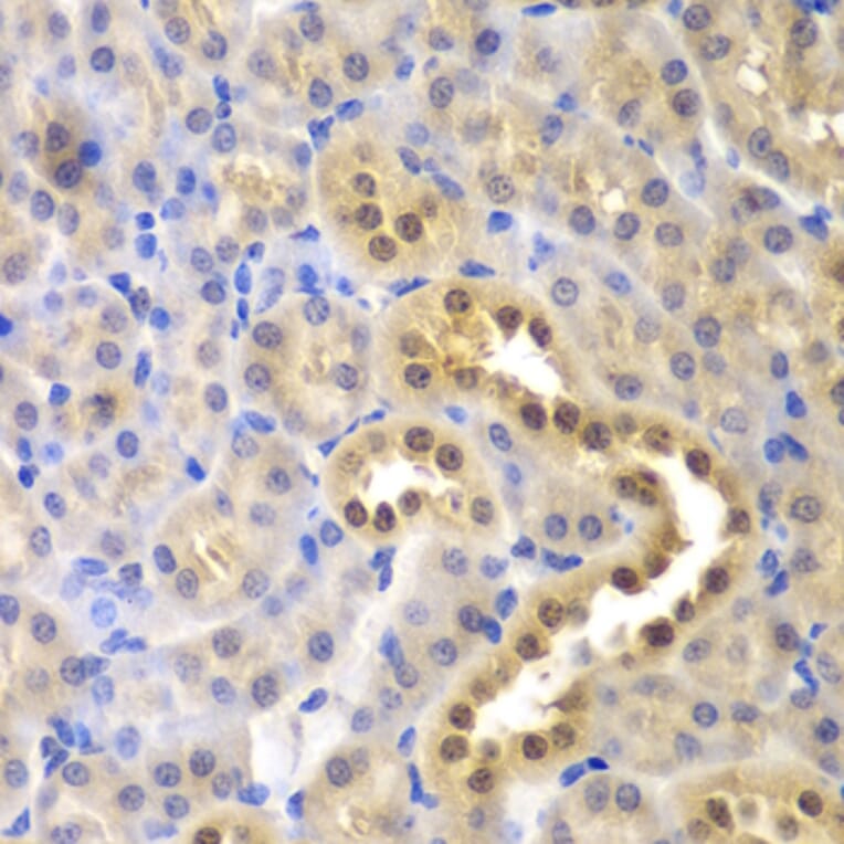 Immunohistochemistry - Anti-GLO1 Antibody (A13752) - Antibodies.com