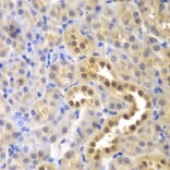 Immunohistochemistry - Anti-GLO1 Antibody (A13752) - Antibodies.com