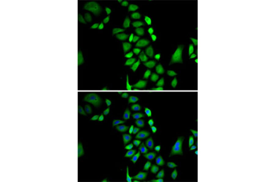 Immunofluorescence - Anti-GLO1 Antibody (A13752) - Antibodies.com