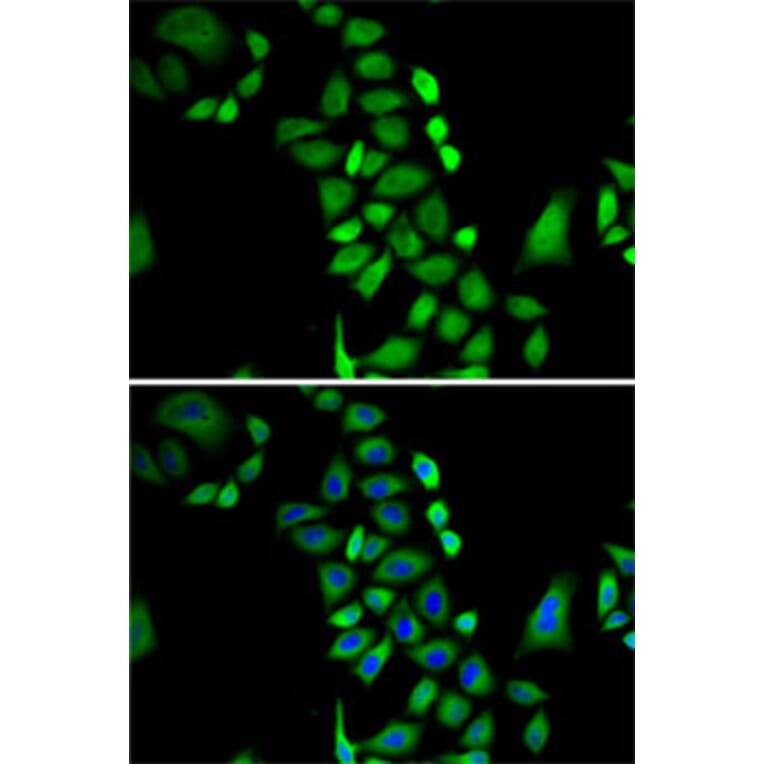 Immunofluorescence - Anti-GLO1 Antibody (A13752) - Antibodies.com