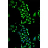 Immunofluorescence - Anti-GLO1 Antibody (A13752) - Antibodies.com