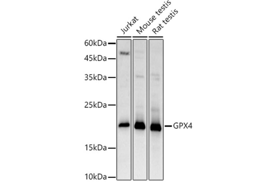 Western Blot - Anti-Glutathione Peroxidase 4 Antibody (A13753) - Antibodies.com