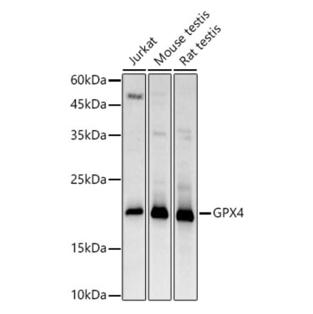 Western Blot - Anti-Glutathione Peroxidase 4 Antibody (A13753) - Antibodies.com