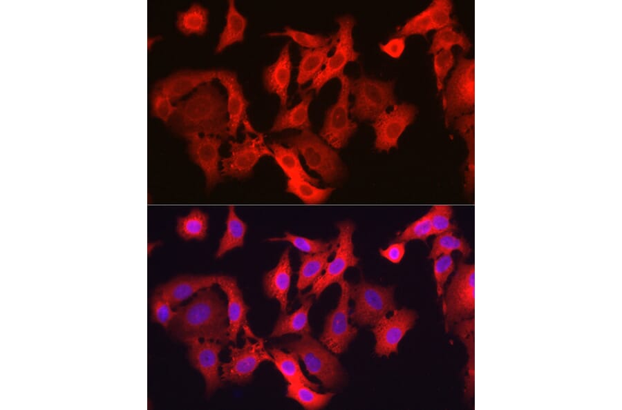 Immunofluorescence - Anti-Glutathione Peroxidase 4 Antibody (A13753) - Antibodies.com