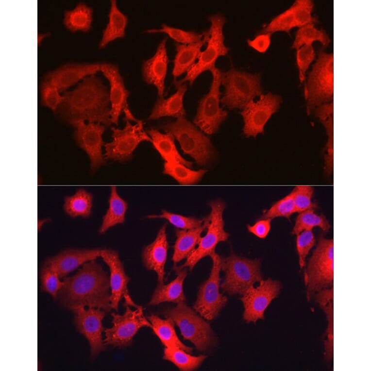 Immunofluorescence - Anti-Glutathione Peroxidase 4 Antibody (A13753) - Antibodies.com