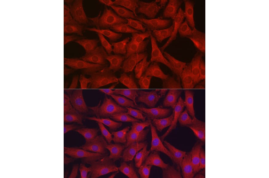 Immunofluorescence - Anti-Glutathione Peroxidase 4 Antibody (A13753) - Antibodies.com