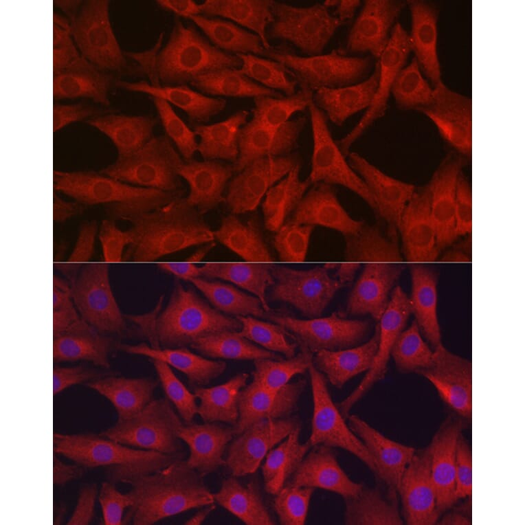 Immunofluorescence - Anti-Glutathione Peroxidase 4 Antibody (A13753) - Antibodies.com