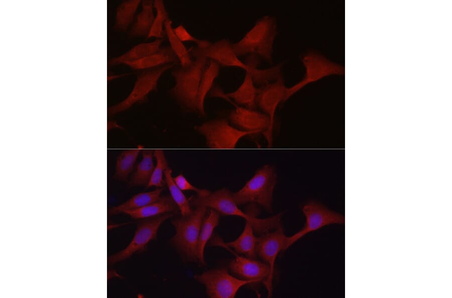 Immunofluorescence - Anti-Glutathione Peroxidase 4 Antibody (A13753) - Antibodies.com
