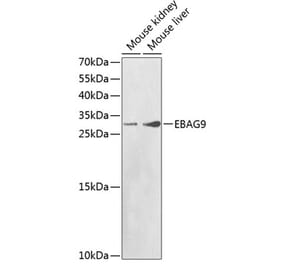 Western Blot - Anti-EBAG9 Antibody (A1935) - Antibodies.com