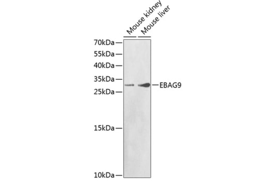 Western Blot - Anti-EBAG9 Antibody (A1935) - Antibodies.com