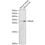 Western Blot - Anti-EBAG9 Antibody (A1935) - Antibodies.com