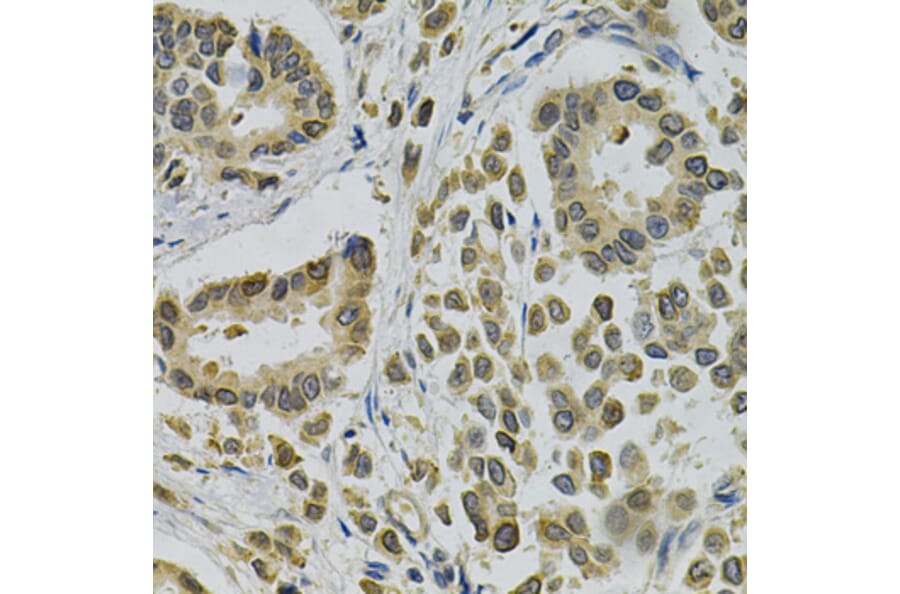 Immunohistochemistry - Anti-EBAG9 Antibody (A1935) - Antibodies.com