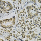 Immunohistochemistry - Anti-EBAG9 Antibody (A1935) - Antibodies.com