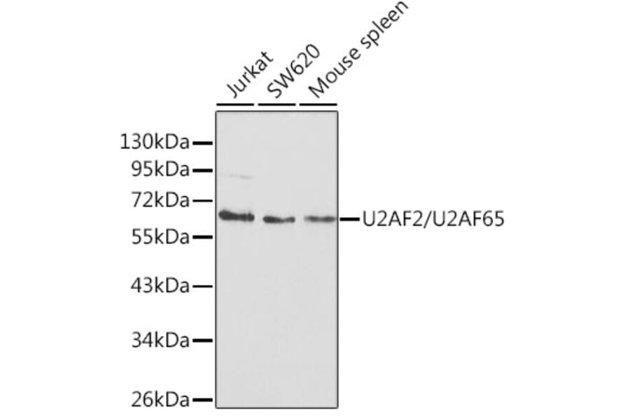Western Blot - Anti-U2AF65 Antibody (A13756) - Antibodies.com