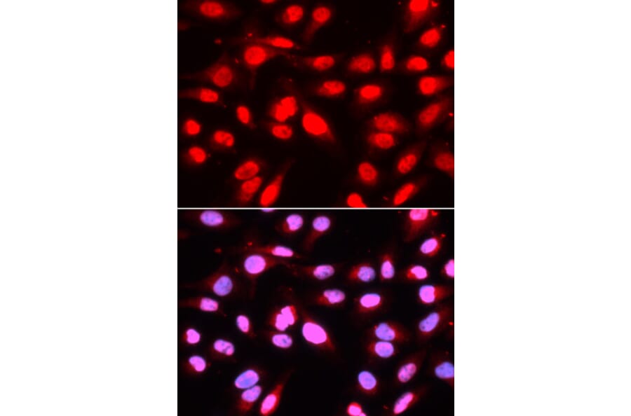 Immunofluorescence - Anti-U2AF65 Antibody (A13756) - Antibodies.com