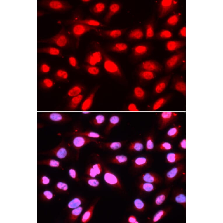 Immunofluorescence - Anti-U2AF65 Antibody (A13756) - Antibodies.com