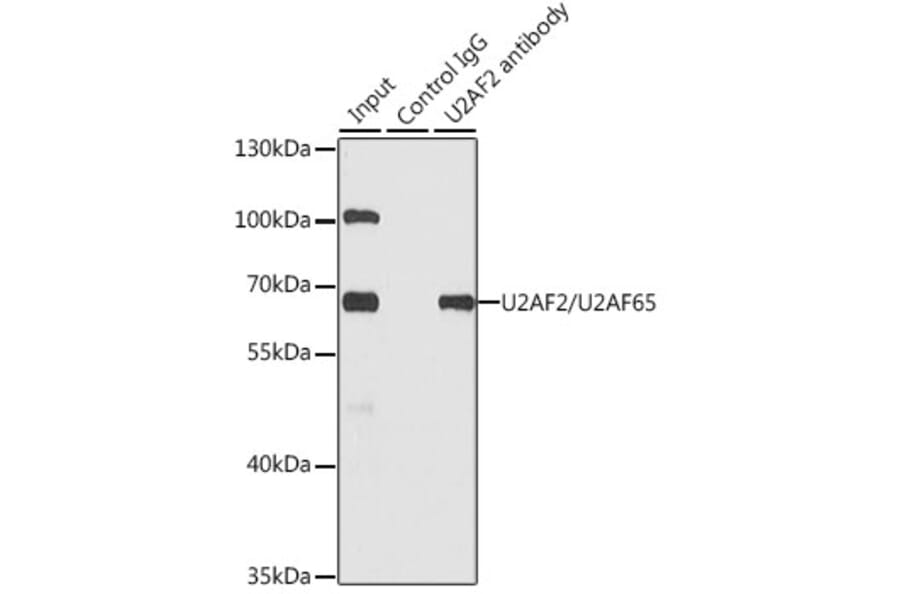 Western Blot - Anti-U2AF65 Antibody (A13756) - Antibodies.com