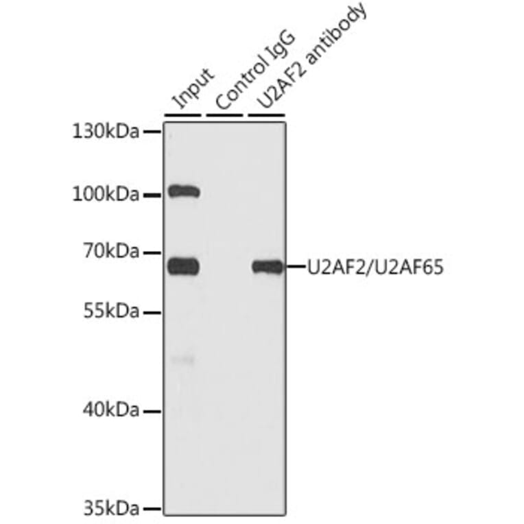 Western Blot - Anti-U2AF65 Antibody (A13756) - Antibodies.com