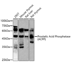 Western Blot - Anti-PAP Antibody (A13757) - Antibodies.com