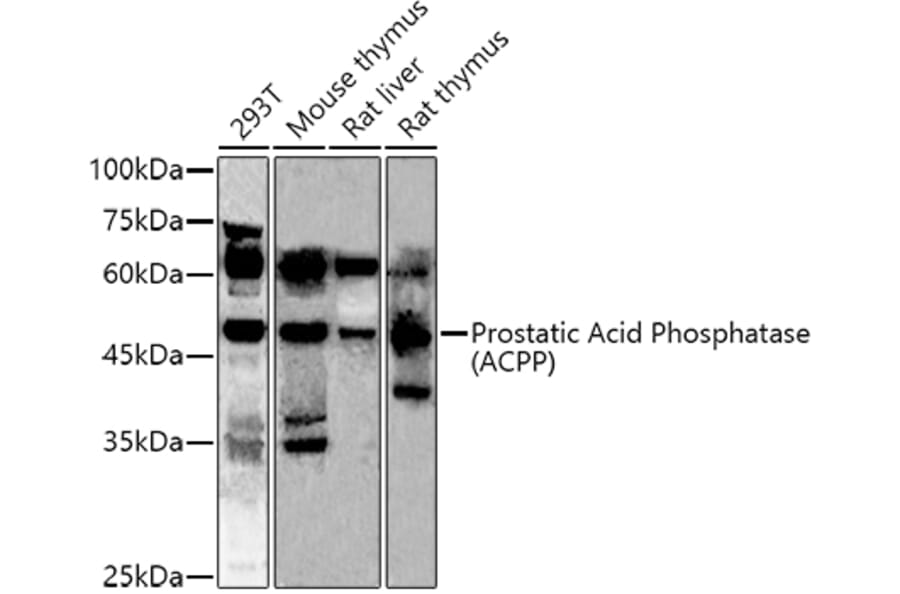 Western Blot - Anti-PAP Antibody (A13757) - Antibodies.com