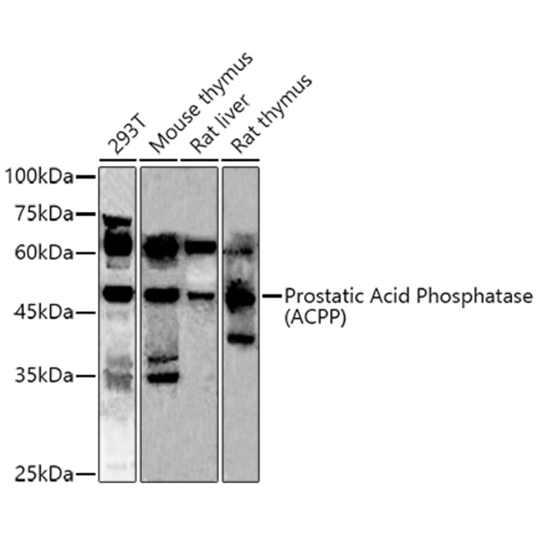 Western Blot - Anti-PAP Antibody (A13757) - Antibodies.com