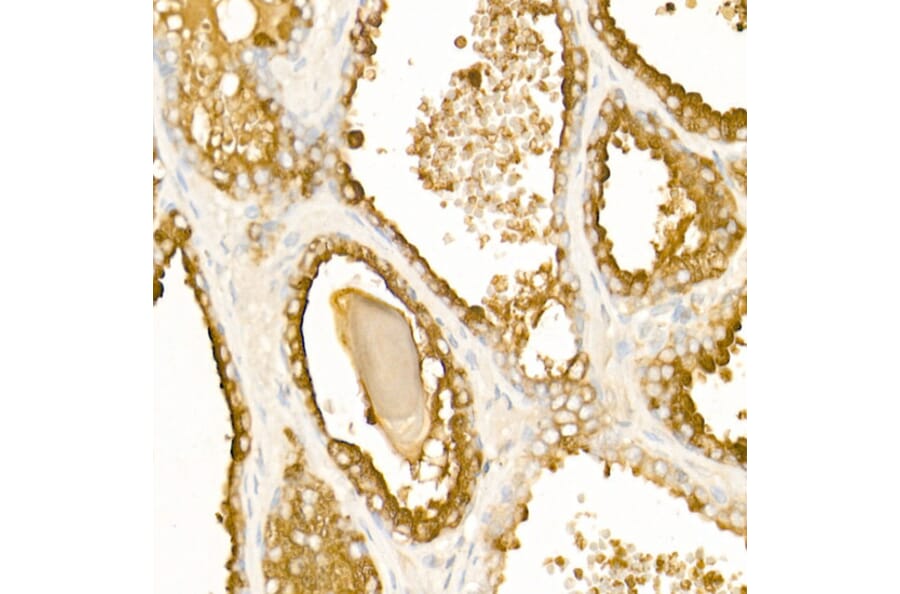 Immunohistochemistry - Anti-PAP Antibody (A13757) - Antibodies.com